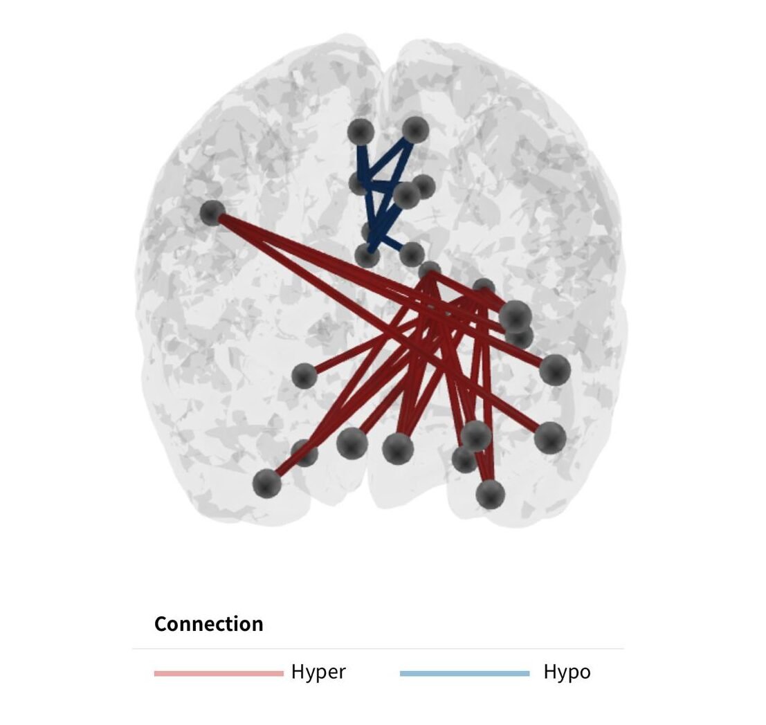 Interconectivitatea dintre regiuni grafic